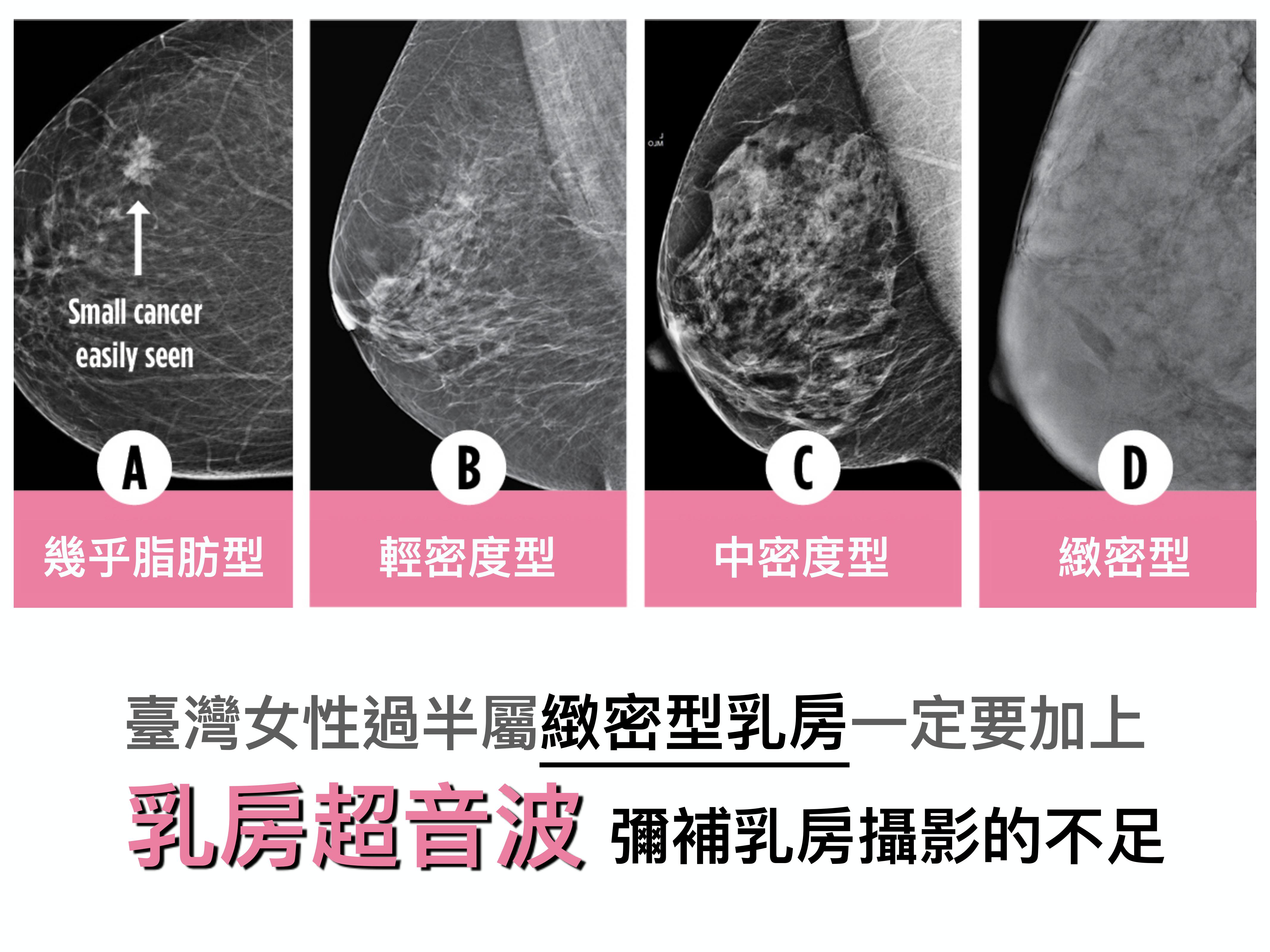 男性乳房丰满引尴尬 烟台山医院开展腔镜手术解患者难言之隐 科教文体 烟台新闻网 胶东在线 国家批准的重点新闻网站